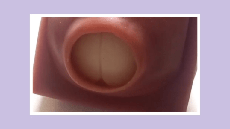 cervix dilating Motherly