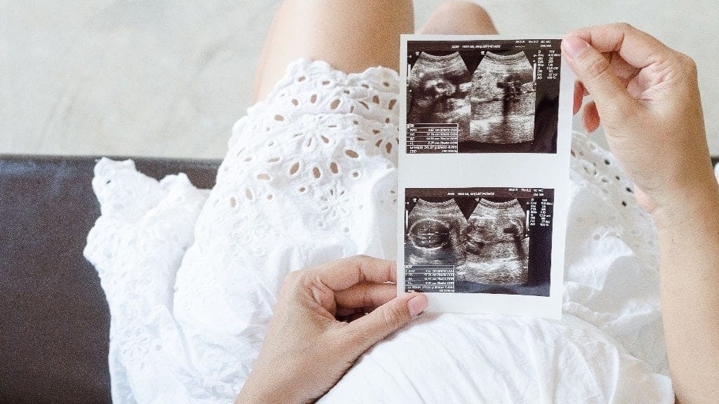 woman holding ultrasound pictures