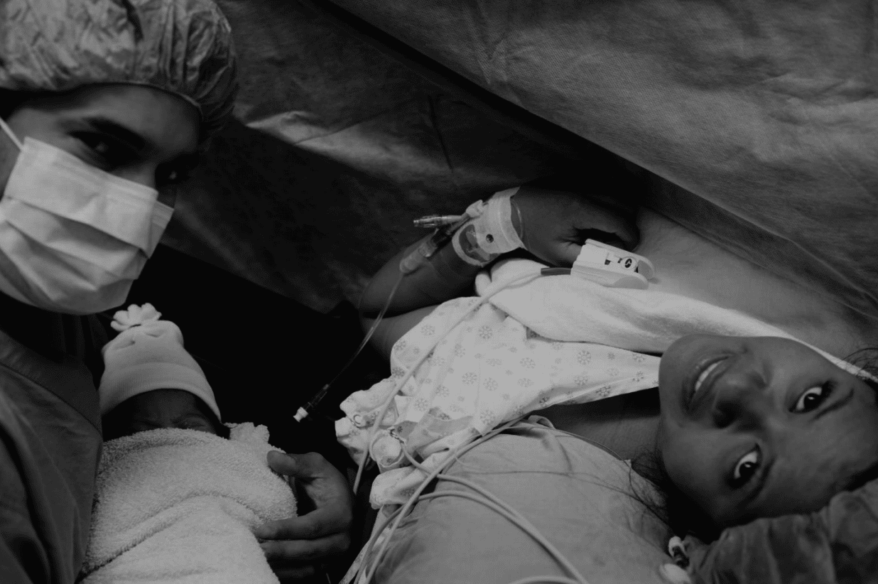 epidural birth story photo