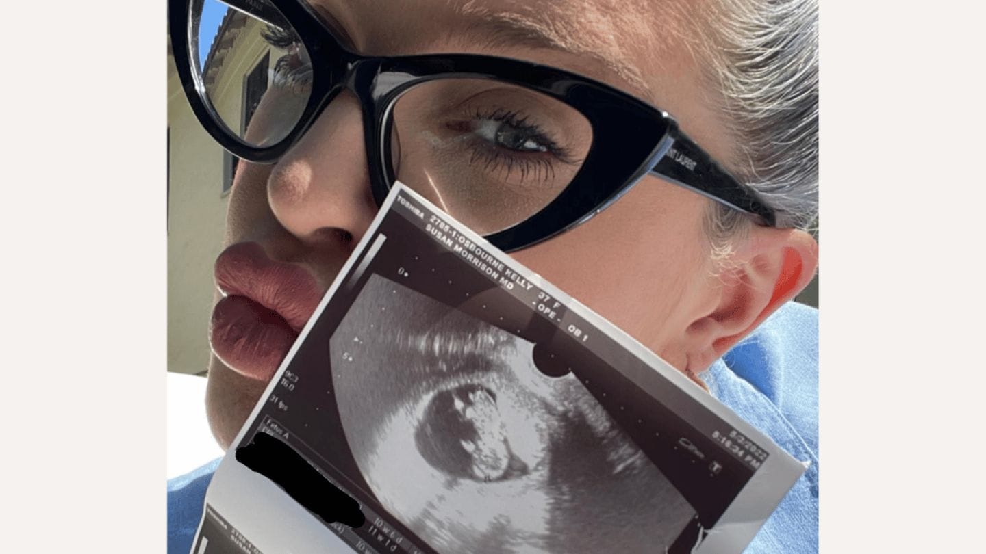 Kelly Osbourne holding ultrasound photo