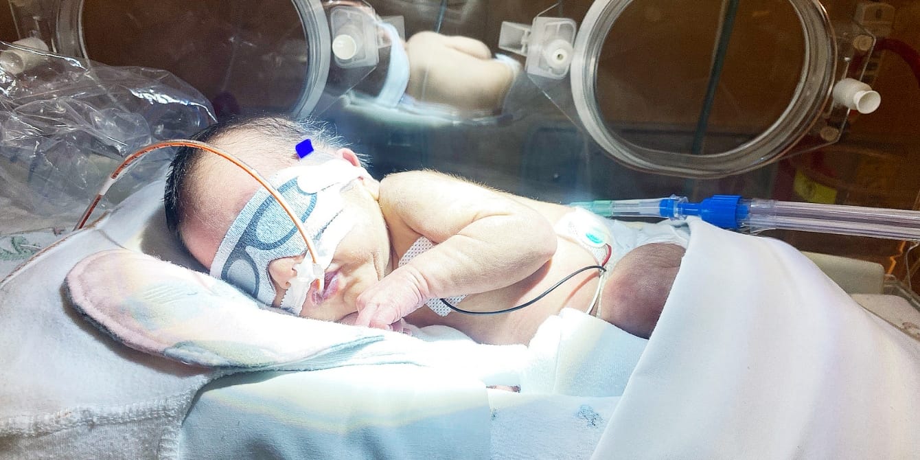 preemie baby in the nicu stay could have been avoided