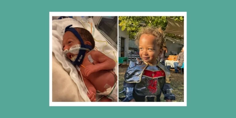 A picture of a baby in the hospital vs now (healthy and strong)